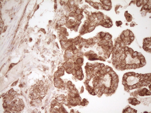 m00068 1 anti cd40 mouse monoclonal antibody clone id oti8b8 ihc testing 2