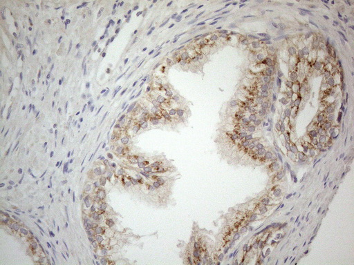 m00068 1 anti cd40 mouse monoclonal antibody clone id oti8b8 ihc testing 6