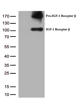 m00070 1 anti igf1 receptor igf1r mouse monoclonal antibody clone id oti4c4 wb testing 1