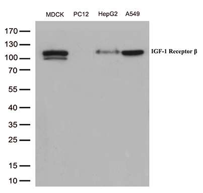 m00070 1 anti igf1 receptor igf1r mouse monoclonal antibody clone id oti4c4 wb testing 2