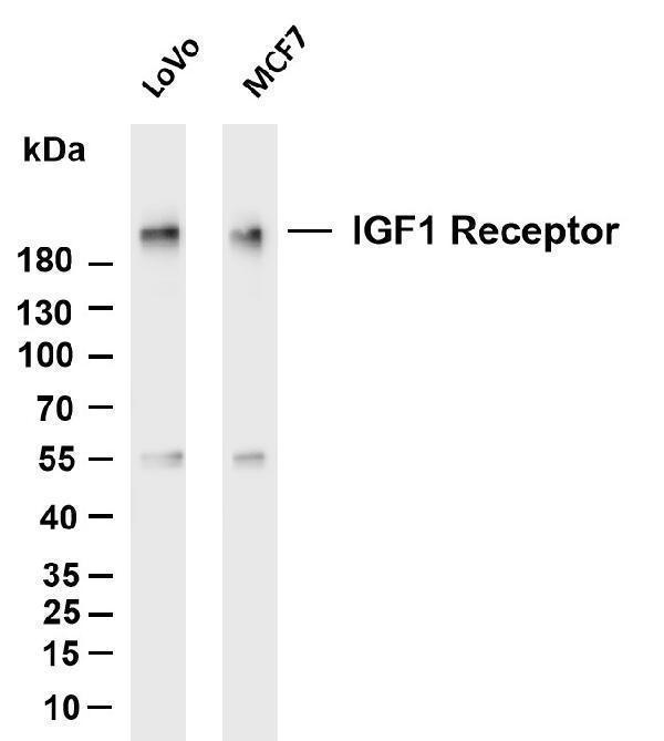 Various whole cell lysates were separated by 4-20% SDS-PAGE, and the membrane was blotted with anti-IGF1 Receptor antibody