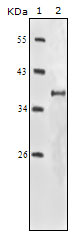 Western Blot analysis using IGF-IR Monoclonal Antibody against truncated IGF-IR recombinant protein