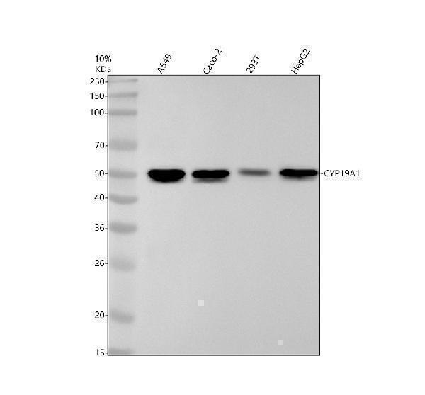 Western blot analysis of CYP19A1 using anti-CYP19A1 antibody (M00071)
