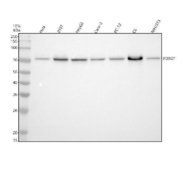 Western blot analysis of FOXO1 using anti-FOXO1 antibody (M00073-1)