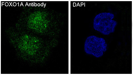 Immunofluorescent analysis of HeLa cells, using FoxO1a Antibody.