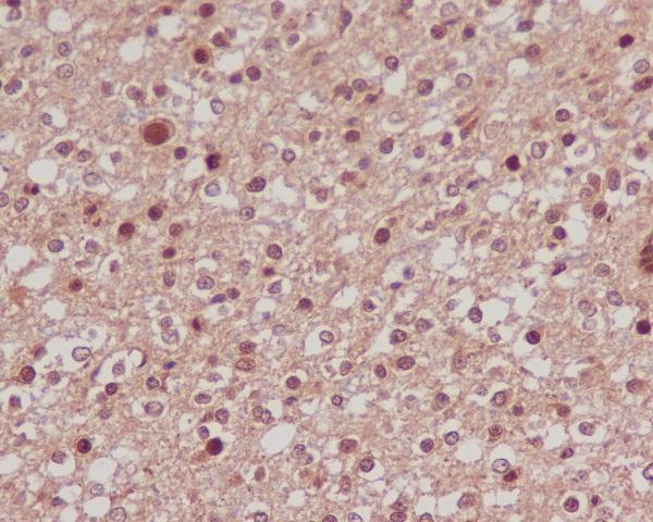 m00073 ihc