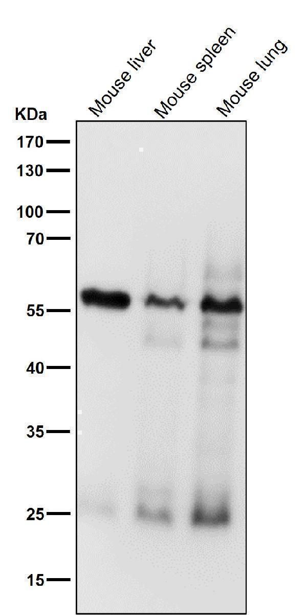 All lanes use the Antibody at 1:2K dilution for 1 hour at room temperature
