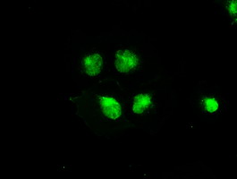 m00075 3 anti b raf braf mouse monoclonal antibody clone id oti5a9 if testing 13