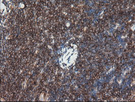 m00075 3 anti b raf braf mouse monoclonal antibody clone id oti5a9 ihc testing 10