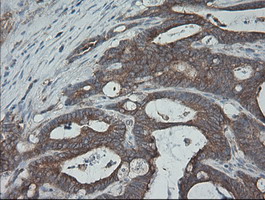 m00075 3 anti b raf braf mouse monoclonal antibody clone id oti5a9 ihc testing 11