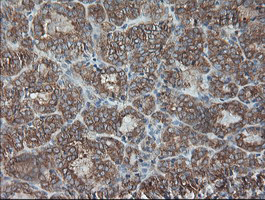 m00075 3 anti b raf braf mouse monoclonal antibody clone id oti5a9 ihc testing 5
