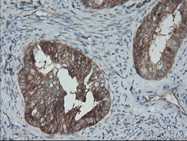 m00075 3 anti b raf braf mouse monoclonal antibody clone id oti5a9 ihc testing 6