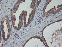 m00075 3 anti b raf braf mouse monoclonal antibody clone id oti5a9 ihc testing 7