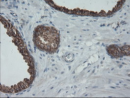 m00075 3 anti b raf braf mouse monoclonal antibody clone id oti5a9 ihc testing 8