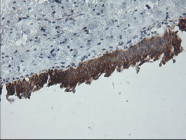 m00075 3 anti b raf braf mouse monoclonal antibody clone id oti5a9 ihc testing 9