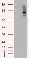 HEK293T cells were transfected with the pCMV6-ENTRY control (Left lane) or pCMV6-ENTRY BRAF (Right lane) cDNA for 48 hrs and lysed
