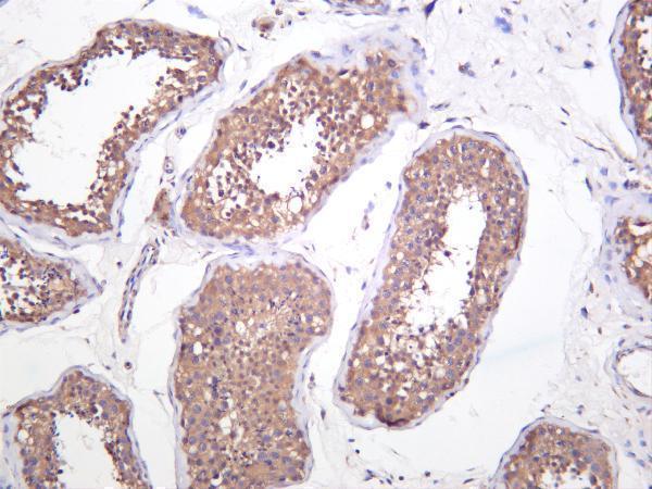 Human testis was stained with anti-Raf-B (phospho Thr401) rabbit antibody