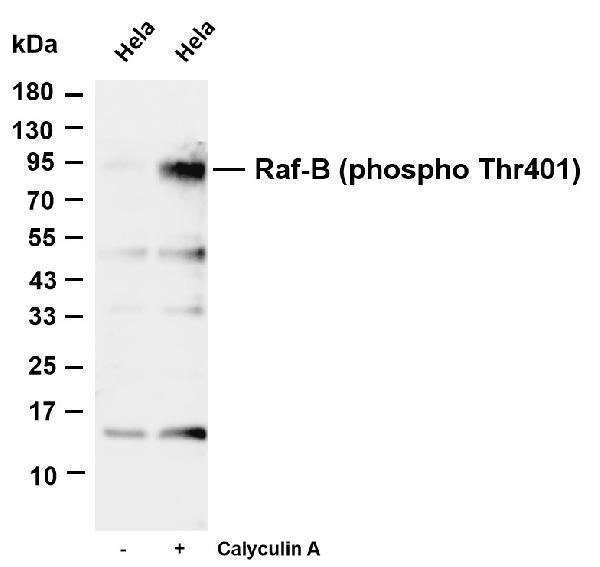 Various whole cell lysates were separated by 4-20% SDS-PAGE, and the membrane was blotted with anti-Raf-B (phospho Thr401) antibody