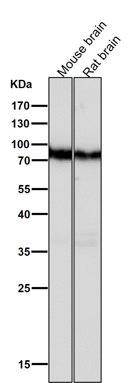 All lanes use the Antibody at 1:2K dilution for 1 hour at room temperature