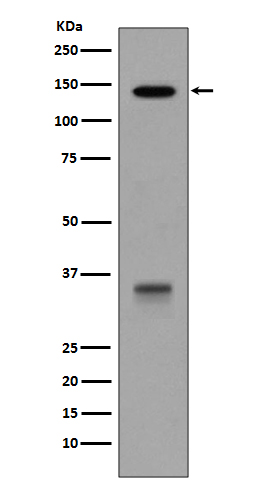 Western blot analysis of LDLR expression in HepG2 cell lysate