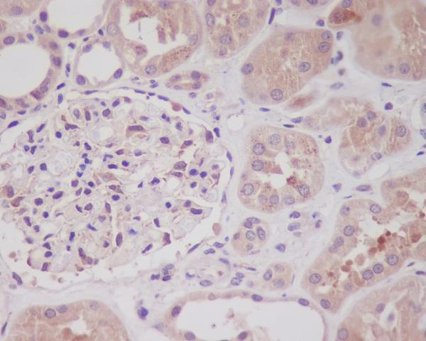 Immunohistochemical analysis of paraffin-embedded human kidney, using Nrf2 Antibody