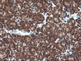 m00079 anti von hippel lindau vhl mouse monoclonal antibody clone id oti1e1 ihc testing 4