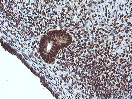 m00079 anti von hippel lindau vhl mouse monoclonal antibody clone id oti1e1 ihc testing 5