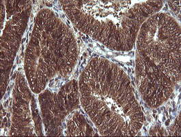 m00079 anti von hippel lindau vhl mouse monoclonal antibody clone id oti1e1 ihc testing 6