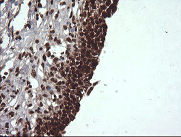 m00079 anti von hippel lindau vhl mouse monoclonal antibody clone id oti1e1 ihc testing 7