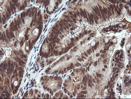 m00079 anti von hippel lindau vhl mouse monoclonal antibody clone id oti1e1 ihc testing 8