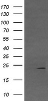 HEK293T cells were transfected with the pCMV6-ENTRY control (Left lane) or pCMV6-ENTRY VHL (Right lane) cDNA for 48 hrs and lysed