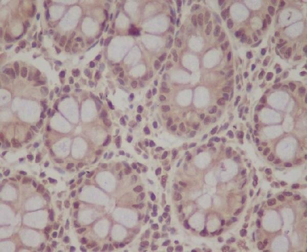 Immunohistochemical analysis of paraffin-embedded human colon, using pro Caspase 9 Antibody