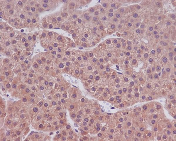 m00080 3 ihc