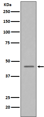 Western blot analysis of Caspase-9 in HeLa cell lysate treated with Camptothecin