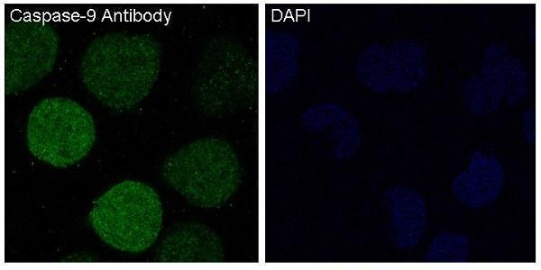 Immunofluorescent analysis of HeLa cells treated with staurosporine, using Caspase-9 Antibody