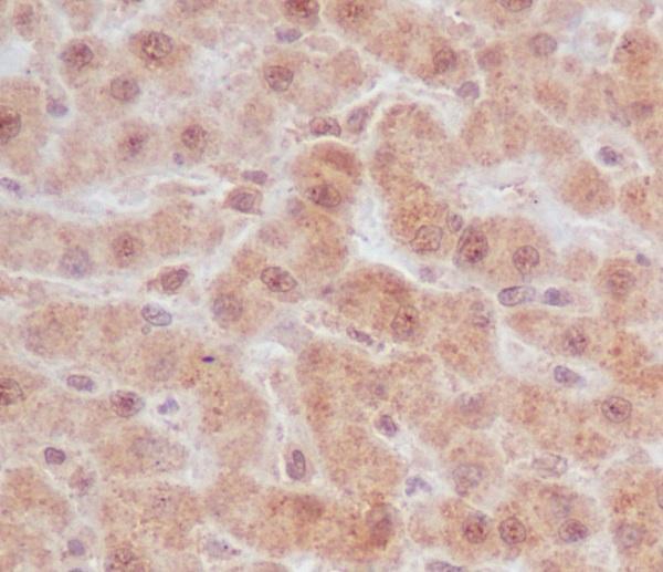 Immunohistochemical analysis of paraffin-embedded human liver, using Caspase-9 Antibody