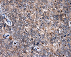m00081 1 anti amyloid precursor protein app mouse monoclonal antibody clone id oti3e3 ihc testing 2