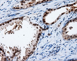 m00081 1 anti amyloid precursor protein app mouse monoclonal antibody clone id oti3e3 ihc testing 3