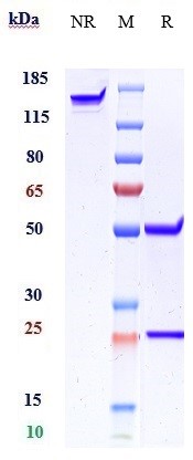 Anti-Amyloid Beta Reference Antibody (GSK 933776) on SDS-PAGE under reducing (R) condition