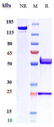Anti-Amyloid Beta Reference Antibody (DLX212) on SDS-PAGE under reducing (R) condition