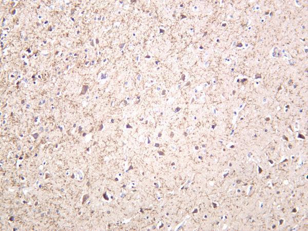 Human brain was stained with anti-Amyloid-β rabbit antibody
