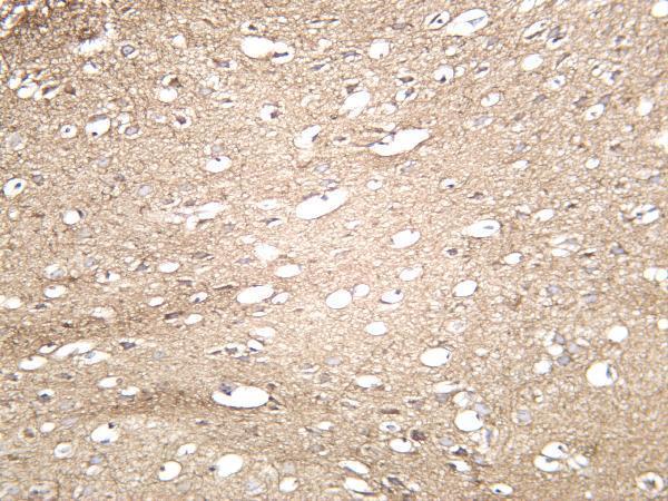 Mouse brain was stained with anti-Amyloid-β rabbit antibody