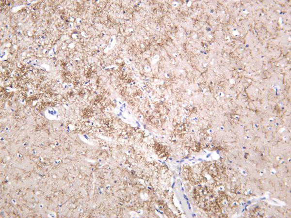 m00081 9 app primary antibodies ihc testing 4