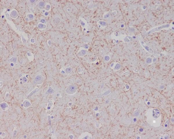 m00081 ihc