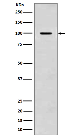 Western blot analysis of Amyloid beta A4 expression in mouse brain lysate