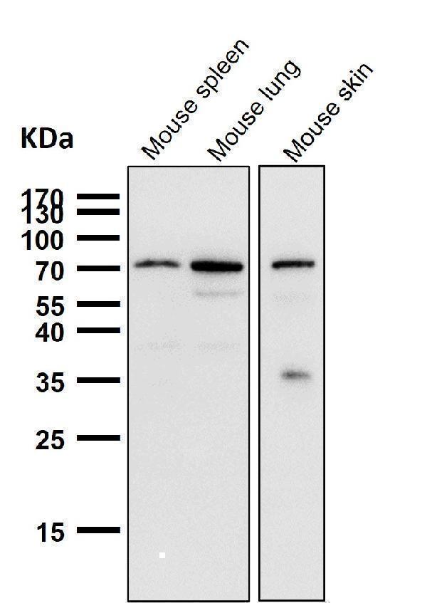 All lanes use the Antibody at 1:1K dilution for 1 hour at room temperature
