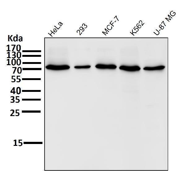 All lanes use the Antibody at 1:1K dilution for 1 hour at room temperature