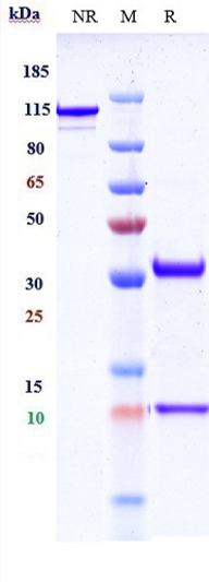 Anti-PCSK9 Reference Antibody (lodelcizumab) on SDS-PAGE under reducing (R) condition