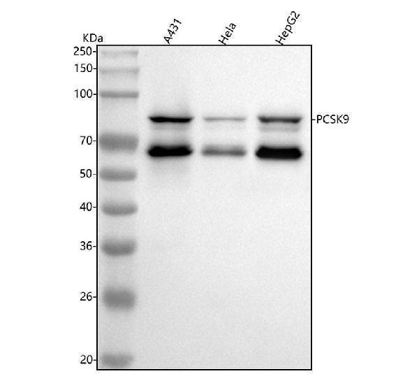  Western blot analysis of PCSK9 using anti-PCSK9 antibody (M00085)