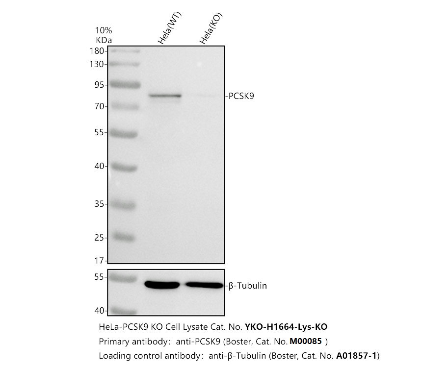 Western blot analysis of PCSK9 using anti-PCSK9 antibody (M00085)